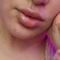 Blixi Desnuda